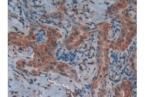 Used in DAB staining on fromalin fixed paraffin-embedded Liver tissue (CD40 Ligand anticorps  (AA 180-261))