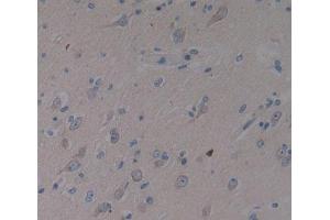 Used in DAB staining on fromalin fixed paraffin- embedded brain tissue (SMS anticorps  (AA 2-366))