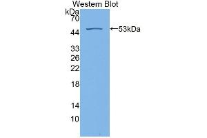 Western blot analysis of the recombinant protein. (RS1 anticorps  (AA 24-224))