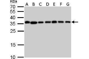 WB Image PPA1 antibody detects PPA1 protein by Western blot analysis. (Pyrophosphatase (Inorganic) 1 (PPA1) anticorps)