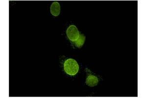 Image no. 1 for anti-Spectrin Repeat Containing, Nuclear Envelope 2 (SYNE2) antibody (ABIN1042629) (SYNE2 anticorps)