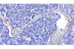 Detection of ELN in Human Pancreas Tissue using Polyclonal Antibody to Elastin (ELN)