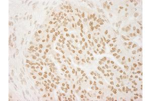 Immunohistochemistry (IHC) image for anti-Protein Arginine Methyltransferase 6 (PRMT6) (C-Term) antibody (ABIN7453949)