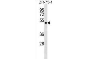 Western Blotting (WB) image for anti-DEAD (Asp-Glu-Ala-Asp) Box Polypeptide 6 (DDX6) antibody (ABIN2999135) (DDX6 anticorps)