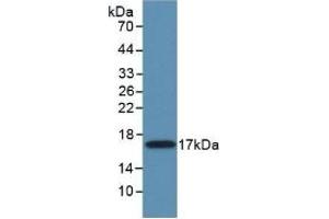 Detection of Recombinant MMP11, Mouse using Polyclonal Antibody to Matrix Metalloproteinase 11 (MMP11) (MMP11 anticorps  (AA 287-491))