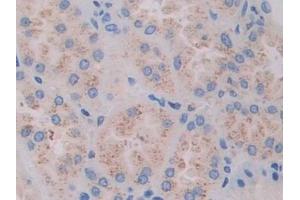 Detection of FLNC in Human Kidney Tissue using Polyclonal Antibody to Filamin C Gamma (FLNC)