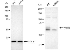 Western blotting analysis using NUMB antibody (ABIN7799693). (Recombinant NUMB anticorps)