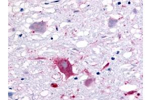Immunohistochemical staining of Brain (Neurons and glia) using anti- GPR32 antibody ABIN122142 (GPR32 anticorps)