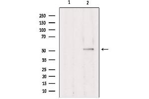 Western blot analysis of extracts from Hepg2, using TRIM38 Antibody.