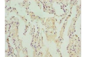 Immunohistochemistry of paraffin-embedded human lung tissue using ABIN7171726 at dilution of 1:100 (ZBTB48 anticorps  (AA 1-280))
