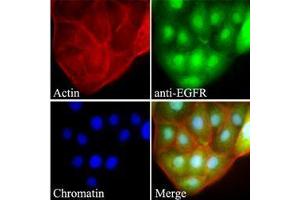 Image no. 2 for anti-Epidermal Growth Factor Receptor (EGFR) (AA 424-605) antibody (ABIN782452) (EGFR anticorps  (AA 424-605))