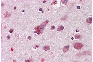 Anti-ELOVL5 antibody  ABIN960769 IHC staining of human brain, cortex. (ELOVL5 anticorps  (Internal Region))