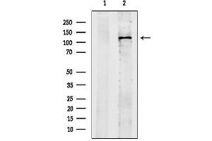 Western blot analysis of lysates from Rat brain, using DIAPH3 Antibody.