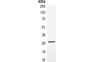 Immunoprecipitation of VSV-G-tagged protein from HEK293T cells transfected with vector overexpressing VSV-G tag, using Anti-VSV-G-tag Antibody. (VSV-g Tag anticorps)