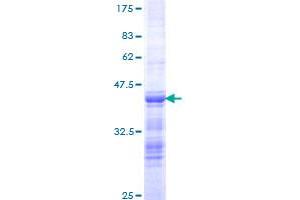 Image no. 1 for PDS5, Regulator of Cohesion Maintenance, Homolog B (PDS5B) (AA 1168-1259) protein (GST tag) (ABIN1314586)