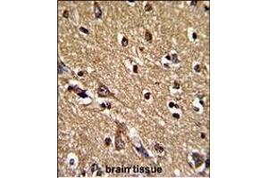 anti-Peroxiredoxin 2 (PRDX2) (AA 98-127) antibody