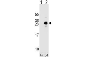 Western Blotting (WB) image for anti-Sclerostin (SOST) antibody (ABIN2912280) (Sclerostin anticorps)