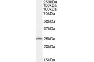 Western Blotting (WB) image for anti-SAR1 Homolog B (SAR1B) (AA 104-116) antibody (ABIN292166) (SAR1B anticorps  (AA 104-116))