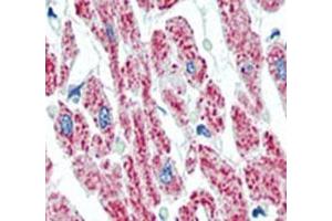 IHC analysis of FFPE human heart tissue stained with Aconitase 2 antibody. (ACO2 anticorps  (AA 438-467))