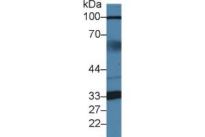 Detection of ZBP1 in Human Serum using Polyclonal Antibody to Z-DNA Binding Protein 1 (ZBP1) (ZBP1 anticorps  (AA 10-167))