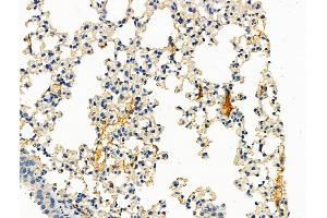 ABIN7093259 and ABIN7097276 at 1/100 staining Mouse lung tissue by IHC-P. (IL2 Receptor beta anticorps  (pTyr364))