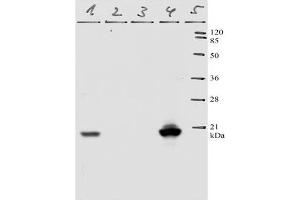 Western-Blot analysis of HPV-11 E7 protein. (Human Papilloma Virus 11 E7 (HPV-11 E7) (AA 36-70) anticorps)