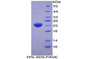 SDS-PAGE analysis of Human Interferon alpha 2 Protein. (IFNA2 Protéine)