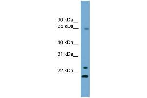 WB Suggested Anti-ZNF37A Antibody Titration:  0. (ZNF37A anticorps  (Middle Region))