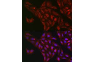 Immunofluorescence analysis of U2OS cells using NQO1 Rabbit pAb (ABIN1681096, ABIN3015018, ABIN3015019 and ABIN6213595) at dilution of 1:50 (40x lens).