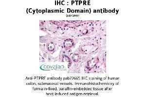 Image no. 1 for anti-Protein tyrosine Phosphatase, Receptor Type, E (PTPRE) (Cytoplasmic Domain) antibody (ABIN1738608) (PTPRE anticorps  (Cytoplasmic Domain))