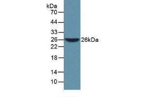 Detection of Recombinant WARS, Mouse using Polyclonal Antibody to Tryptophanyl tRNA Synthetase (WARS)