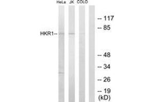 Western blot analysis of extracts from HeLa/Jurkat/COLO205 cells, using HKR1 Antibody. (HKR1 anticorps  (AA 141-190))