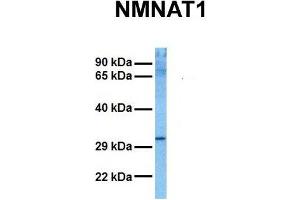 Host:  Rabbit  Target Name:  NMNAT1  Sample Tissue:  Human HCT116  Antibody Dilution:  1.