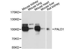 Western blot analysis of extracts of various cell lines, using PALD1 antibody. (KIAA1274 anticorps)