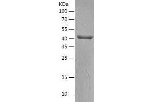 Western Blotting (WB) image for Branched Chain Keto Acid Dehydrogenase E1, alpha Polypeptide (BCKDHA) (AA 46-445) protein (His-IF2DI Tag) (ABIN7122029)