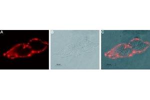 Expression of KCNN4 in live intact human LN-CaP prostate carcinoma cells - Cell surface detection of KCNN4 in live intact human LN-CaP prostate carcinoma cells with Mouse Anti-KCNN4 (KCa3.