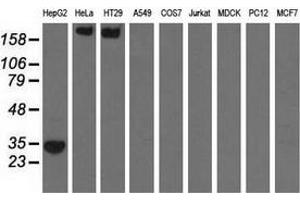 Western blot analysis of extracts (35 µg) from 9 different cell lines by using anti-SULT2A1 monoclonal antibody. (SULT2A1 anticorps)