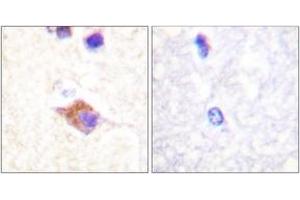 Immunohistochemistry analysis of paraffin-embedded human brain, using PLCG2 (Phospho-Tyr1217) Antibody.