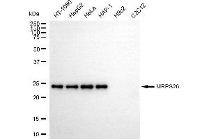 Western blotting analysis using MRPS26 antibody (ABIN7799434). (Recombinant MRPS26 anticorps)