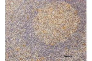 Image no. 1 for anti-Mediator Complex Subunit 21 (MED21) (AA 1-145) antibody (ABIN599079) (MED21 anticorps  (AA 1-145))