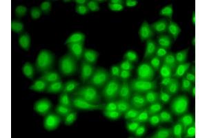 Immunofluorescence (IF) image for anti-Cullin 4B (CUL4B) antibody (ABIN1876588) (Cullin 4B anticorps)