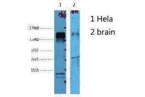 Western Blot (WB) analysis of 1) HeLa, 2) Mouse Brain, diluted at 1:4000. (ErbB2/Her2 anticorps)