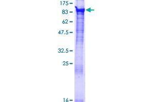 Image no. 1 for Bardet-Biedl Syndrome 7 (BBS7) (AA 1-715) protein (GST tag) (ABIN1346477)