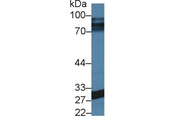 CA5A anticorps  (AA 12-219)