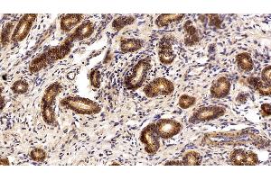 Detection of EPCAM in Porcine Uterus Tissue using Polyclonal Antibody to Epithelial Cell Adhesion Molecule (EPCAM) (EpCAM anticorps  (AA 25-265))