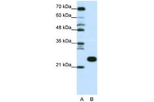 WB Suggested Anti-RPL13 Antibody Titration:  0. (RPL13 anticorps  (C-Term))