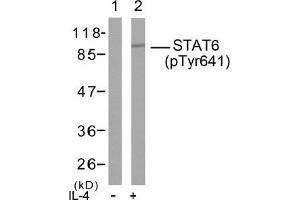 Image no. 2 for anti-Signal Transducer and Activator of Transcription 6, Interleukin-4 Induced (STAT6) (pTyr641) antibody (ABIN196700) (STAT6 anticorps  (pTyr641))