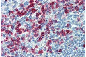 Human Spleen: Formalin-Fixed, Paraffin-Embedded (FFPE) (SELPLG anticorps)