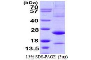 Figure annotation denotes ug of protein loaded and % gel used. (ATF3 Protein (AA 1-181))