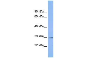 Host: Rabbit Target Name: C6orf203 Sample Type: Fetal Kidney lysates Antibody Dilution: 1. (C6ORF203 anticorps  (C-Term))